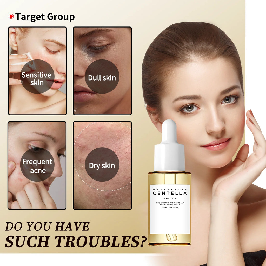 Centella Asiatica Brightening Serum: Calms Irritation, Reduces Breakouts, Balances Sebum & Diminishes Dark Marks for Clear Skin.